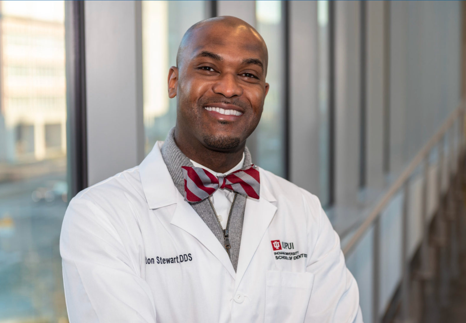 UtterWhite Teeth Whitening Products - Before and After Results